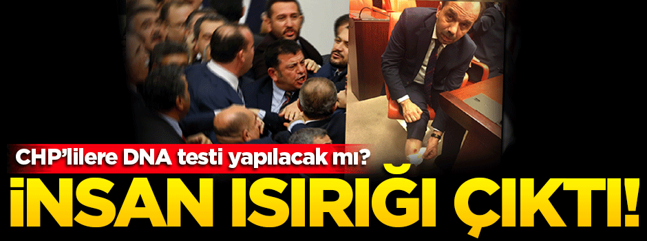 Adli Tıp'ın 'ısırık raporu' ortaya çıktı!