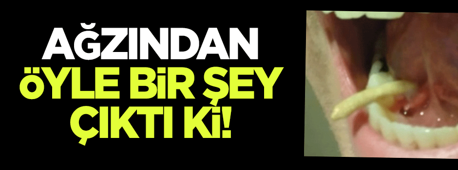 Ağzından öyle bir şey çıktı ki!