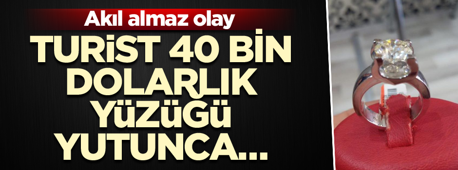 Akıl almaz olay… Turist 40 bin dolarlık yüzüğü yutunca…
