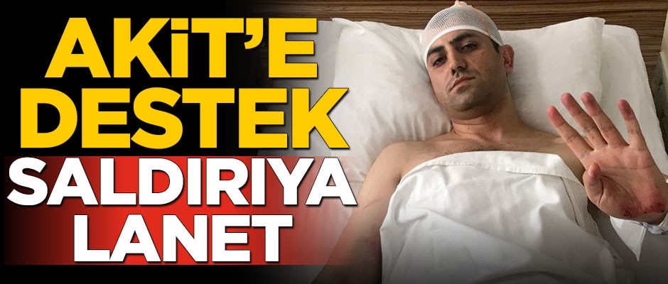 Akit’e destek, saldırıya lanet