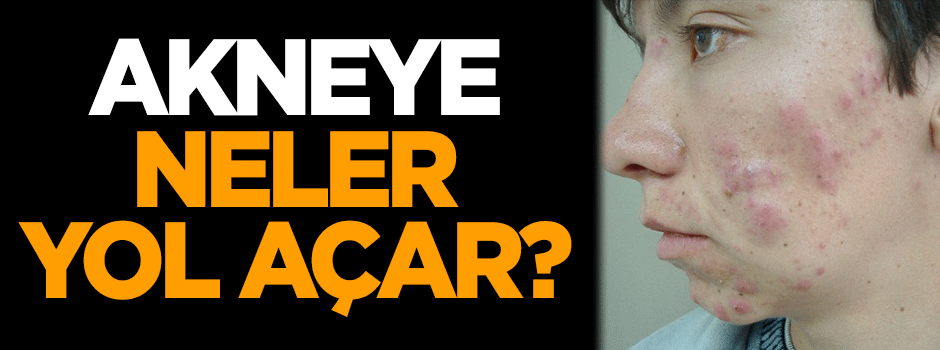 Akneye neler yol açar?