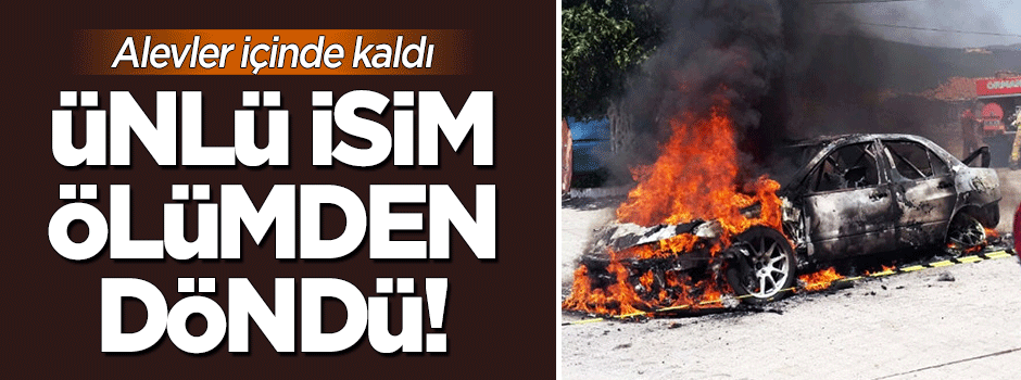 Alevler içinde kaldı! Ünlü isim ölümden döndü