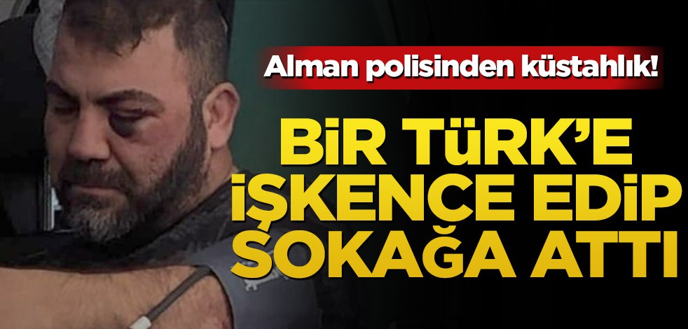 Alman polisinden küstahlık! Bir Türk’e işkence edip sokağa attı
