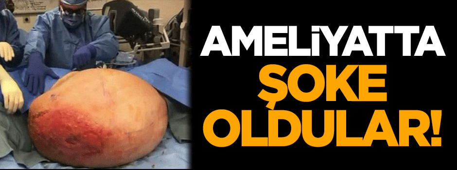 Ameliyatta şok oldular!