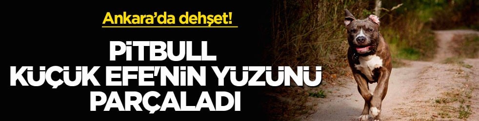 Ankara’da dehşet! Pitbull küçük Efe'nin yüzünü parçaladı