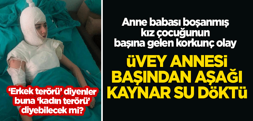 Anne babası boşanmış kız çocuğunun başına gelen korkunç olay! Üvey annesi kaynar su döktü