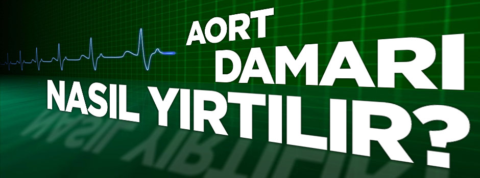 Aort damarı nasıl yırtılır?