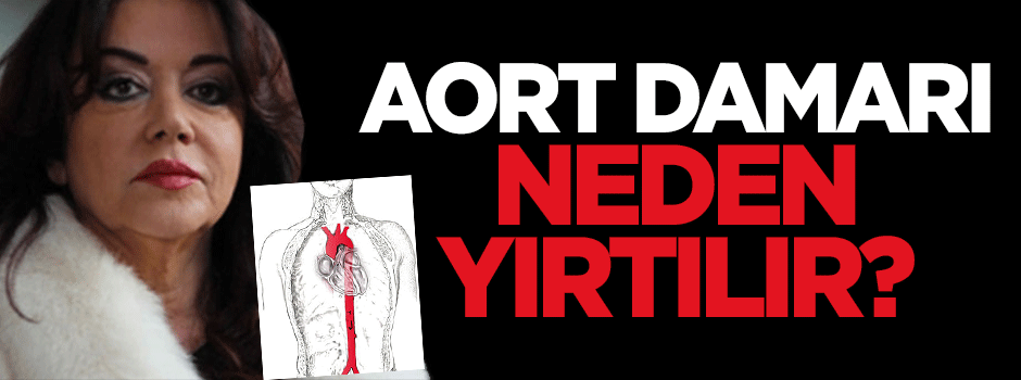 Aort damarı neden yırtılır?