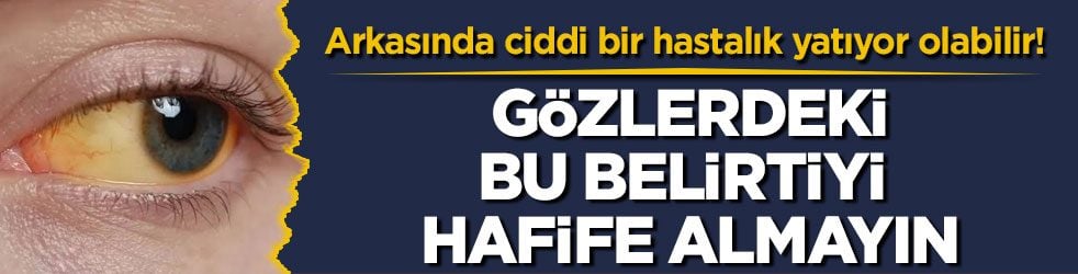 Arkasında ciddi bir hastalık yatıyor olabilir! Gözlerdeki bu belirtiyi hafife almayın