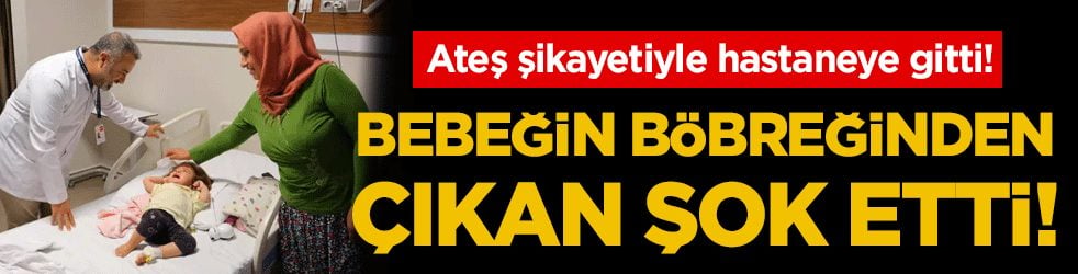 Ateş şikayetiyle hastaneye gitti: Bebeğin böbreğinden çıkan şok etti