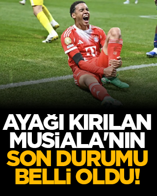 Ayağı kırılan Musiala'nın son durumu belli oldu!