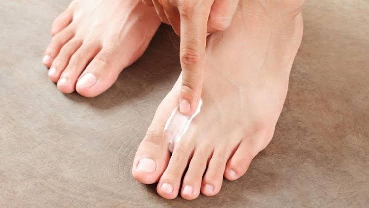 Ayak mantarı neden oluşur? Ayak mantarı bulaşıcı mı?