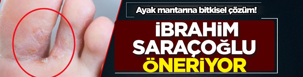 Ayak mantarına bitkisel çözüm: 5 dakika! Mantara karşı esir olmayın! Prof. Dr. İbrahim Saraçoğlu öneriyor