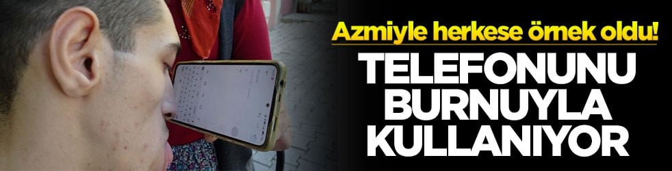 Azmiyle herkese örnek oldu! Telefonunu burnuyla kullanıyor