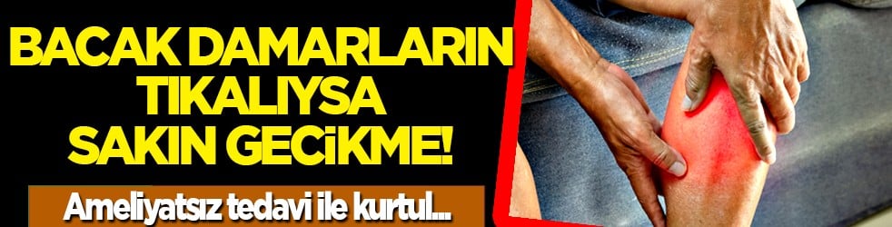 Bacak damarların tıkalıysa sakın gecikme! Ameliyatsız tedavi ile ağrılarından kurtul