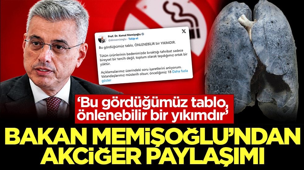 Bakan Memişoğlu’ndan akciğer paylaşımı: Bu gördüğümüz tablo, önlenebilir bir yıkımdır