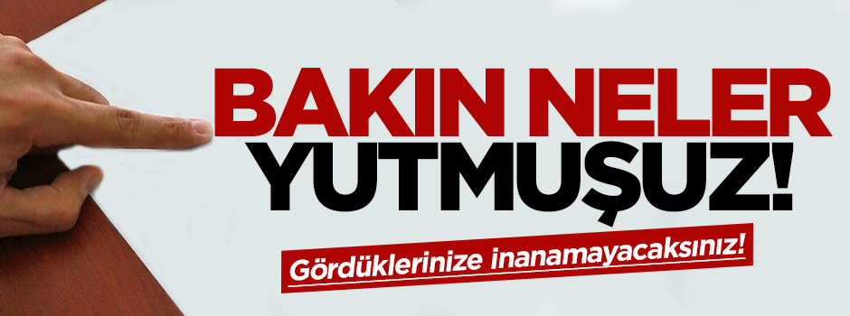 Bakın neler yutmuşuz!