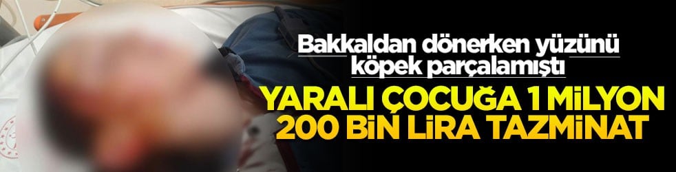 Bakkaldan dönerken yüzünü köpek parçalamıştı! Yaralı çocuğa 1 milyon 200 bin lira tazminat