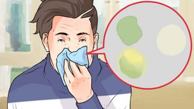 Balgam söktürücü evde ne yapılabilir?