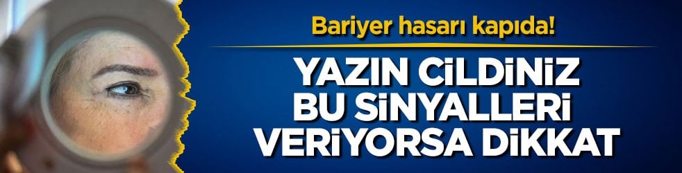 Bariyer hasarı kapıda! Yazın cildiniz bu sinyalleri veriyorsa dikkat