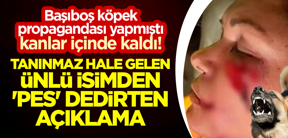 Başıboş köpek propagandası yapmıştı, kanlar içinde kaldı! Tanınmaz hale gelen ünlü isimden 'pes' dedirten açıklama
