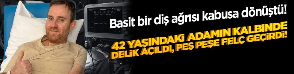 Basit bir diş ağrısı kabusa dönüştü! 42 yaşındaki adamın kalbinde delik açıldı, peş peşe felç geçirdi!