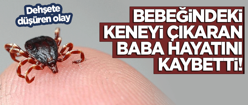 Bebeğindeki keneyi çıkardıktan sonra hayatını kaybetti!