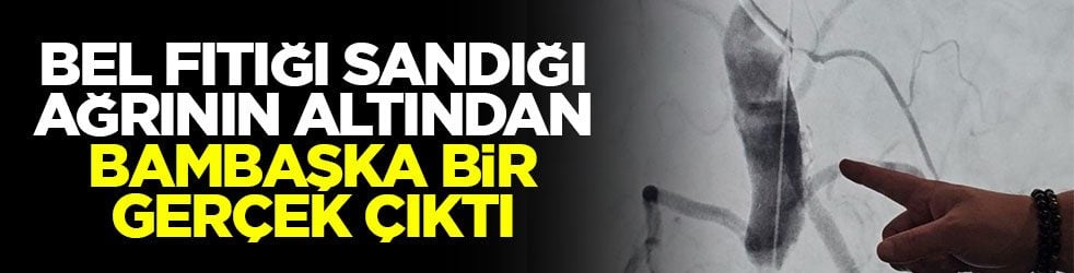 Bel fıtığı sandığı ağrının altından bambaşka bir gerçek çıktı!