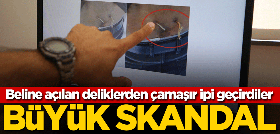 Beline açılan deliklerden çamaşır ipi geçirdiler! Büyük skandal