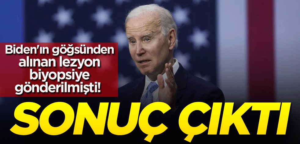 Biden'ın göğsünden alınan lezyon, biyopsiye gönderilmişti! Sonuç belli oldu