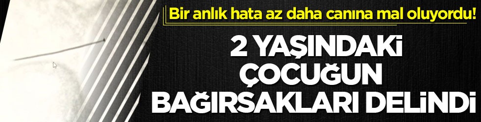 Bir anlık hata az daha canına mal oluyordu! 2 yaşındaki çocuğun bağırsakları delindi
