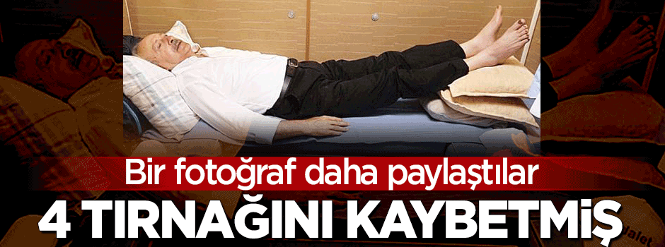 Bir fotoğraf daha paylaştılar... Kılıçdaroğlu yürüyüşte 4 tırnağını kaybetmiş