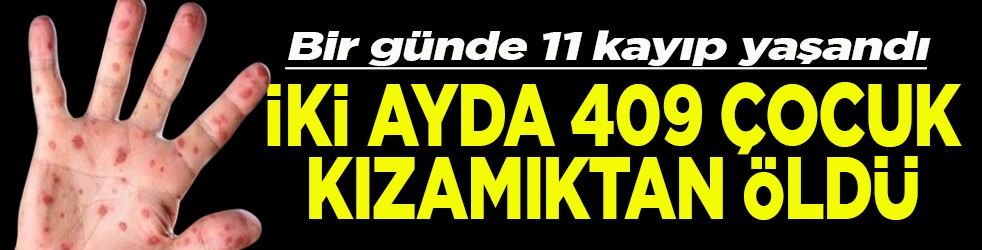 Bir günde 11 kayıp yaşandı İki ayda 409 çocuk kızamıktan öldü