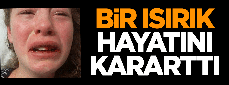 Bir ısırık hayatını kararttı!