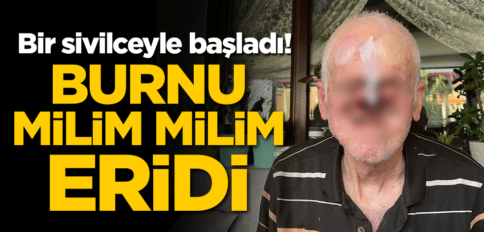 Bir sivilceyle başladı! Burnu milim milim eridi