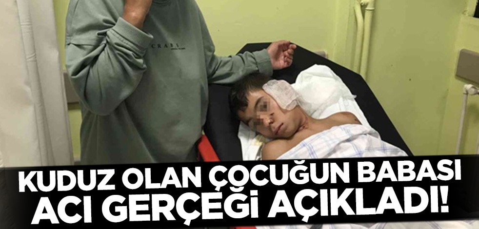 Bitlis'te köpek ısırması sonucu kuduz olan çocuğun babası acı gerçeği açıkladı!
