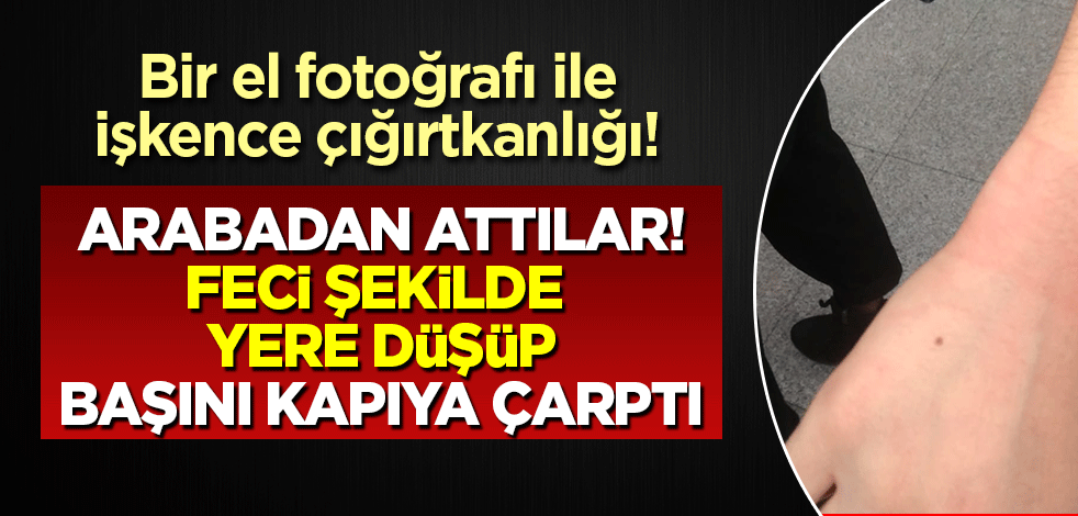 Boğaziçi provokatörleri hafif kızarık bir el fotoğrafı ile bunu iddia ettiler: Müvekkilim feci şekilde darp edildi