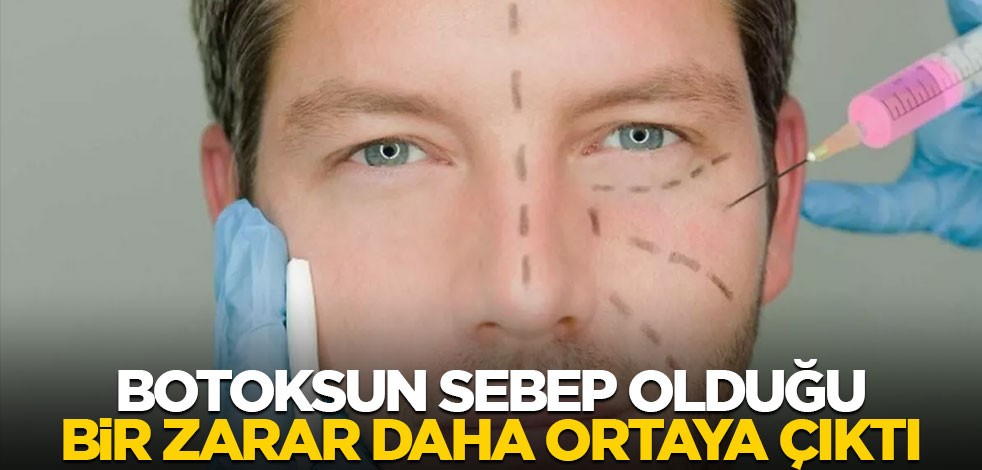 Botoksun sebep olduğu bir zarar daha ortaya çıktı