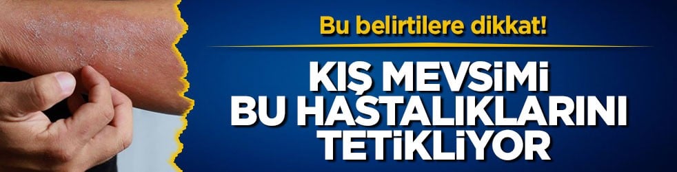Bu belirtilere dikkat! Kış mevsimi bu hastalıklarını tetikliyor