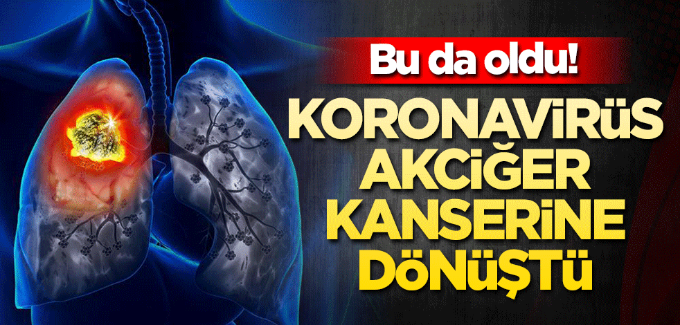Bu da oldu! Koronavirüs akciğer kanserine dönüştü