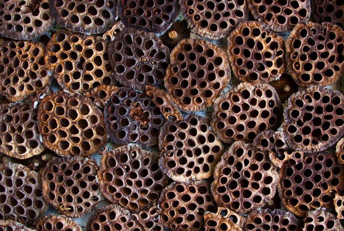 Bu fotoğraflara bakamıyorsanız dikkat! Rahatsızlığınız olabilir