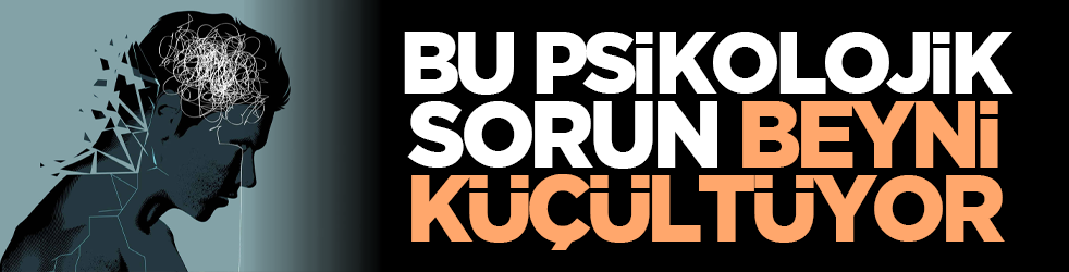 Bu psikolojik sorun beyni küçültüyor