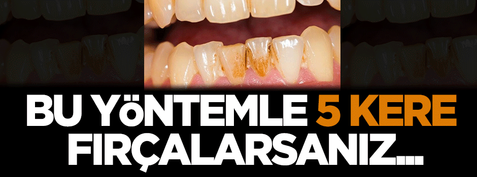Bu yöntemle 5 kez fırçalarsanız...