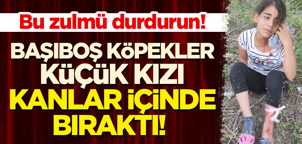 Bu zulmü durdurun: Başıboş köpekler, küçük kızı kanlar içinde bıraktı!