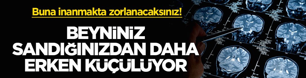 Buna inanmakta zorlanacaksınız! Beyniniz sandığınızdan daha erken küçülüyor