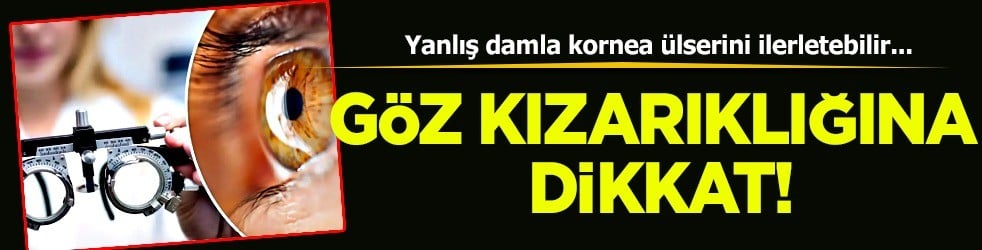  Bunu yapma: Uzmanı yanlış olur dedi kimse inanamadı! Gözünüzdeki kızarıklık: Yanlış damla ülser yapabilir