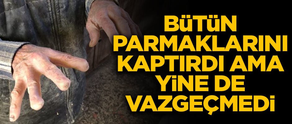 Bütün parmaklarını kaptırdı ama yine de vazgeçmedi!