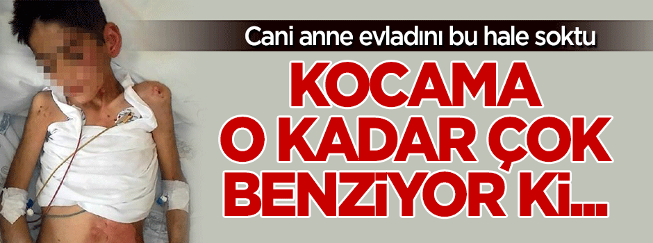 Cani anne kocasına benzediği için çocuğunu bu hale soktu!