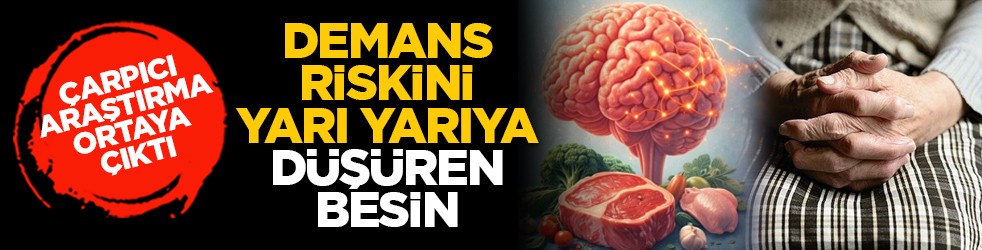 Çarpıcı araştırma ortaya çıktı: Demans riskini yarı yarıya düşüren besin