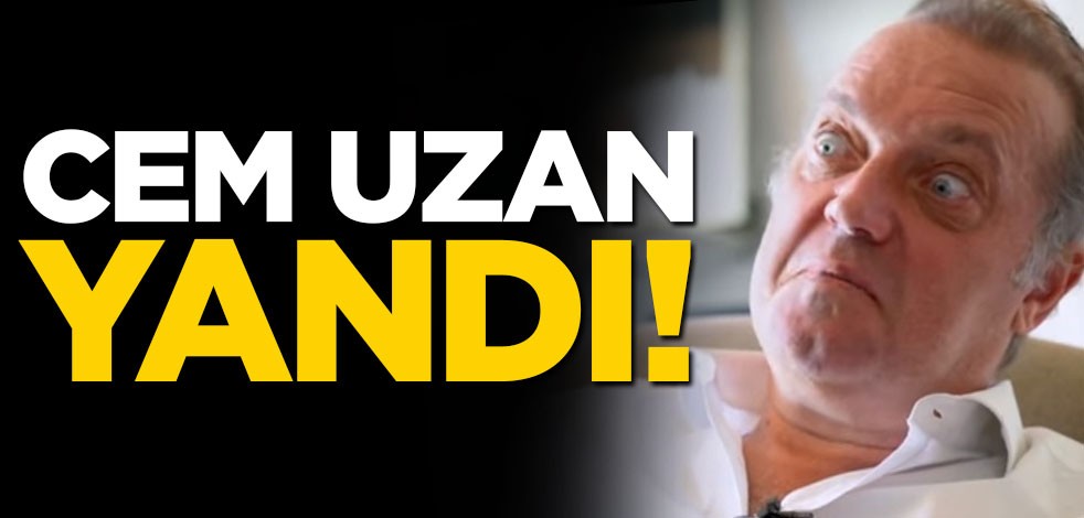 Cem Uzan'ın eli yandı